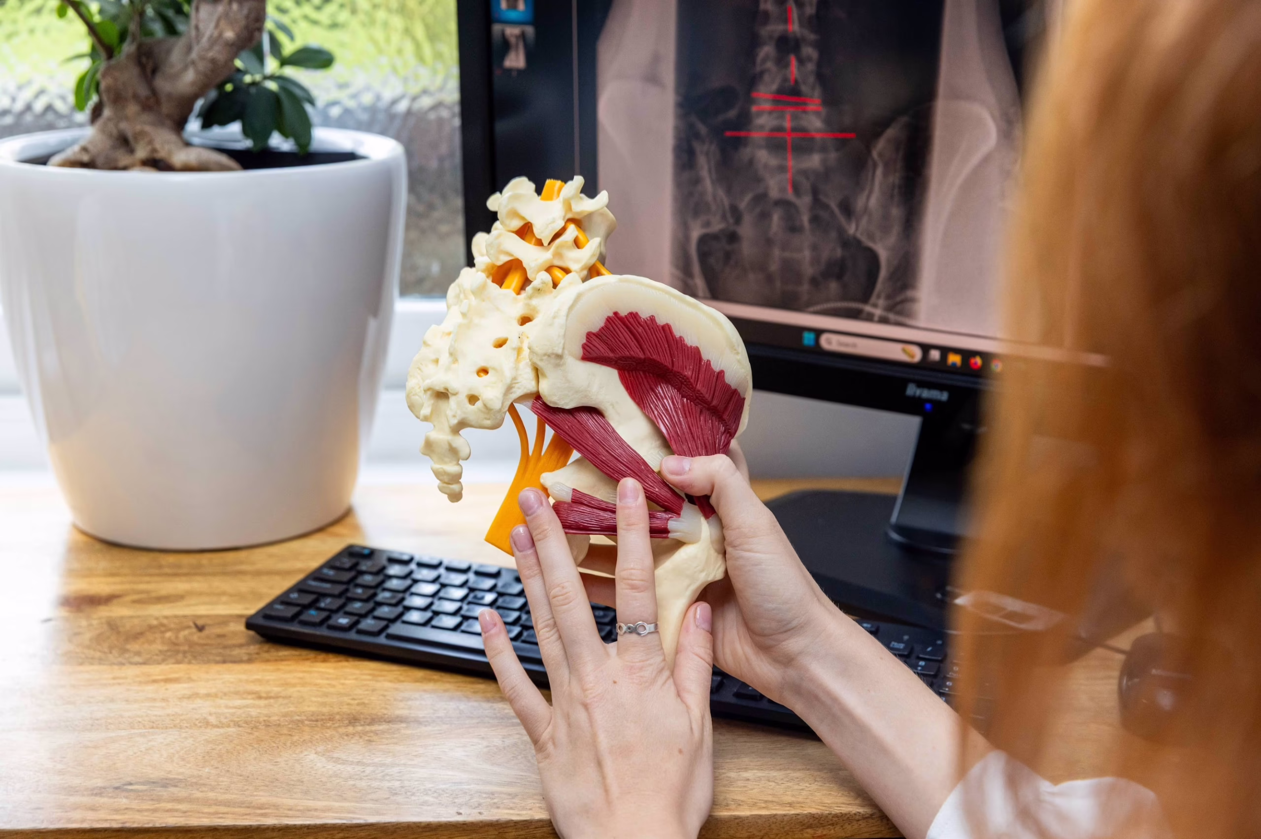 disc model review nerve explanation converted scaled