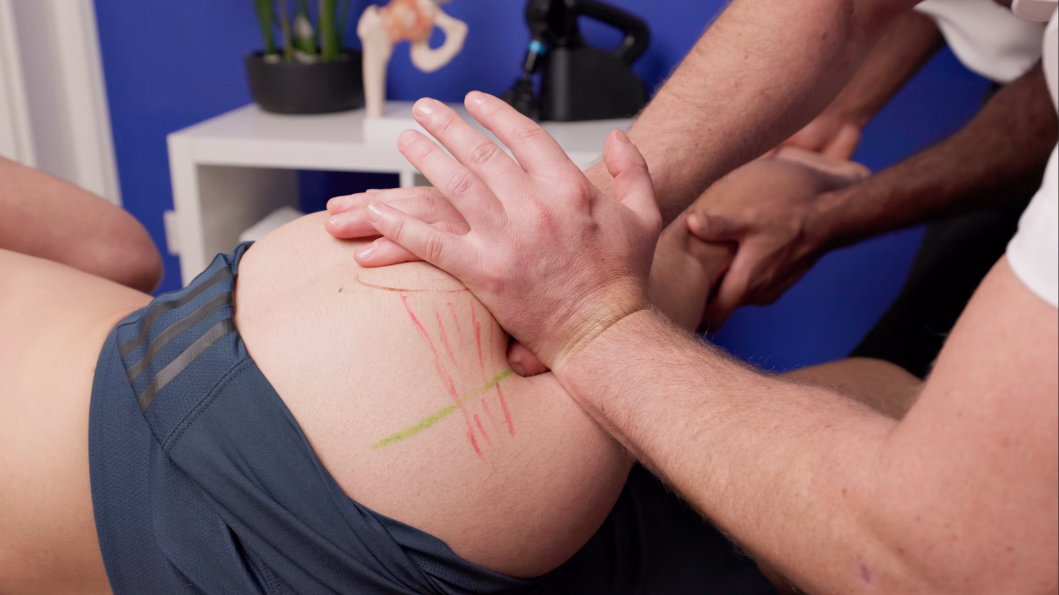 manual gluteal soft tissue treatment close up