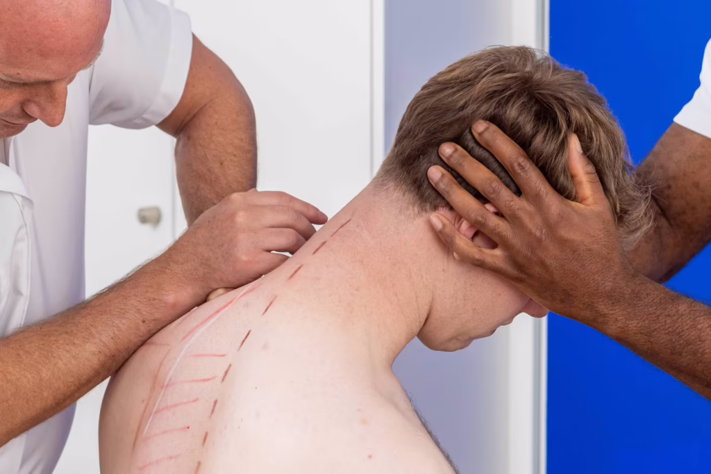 Chiropractor performing upper back adhesion release treatment on a patient’s neck and shoulder area at a Surbiton clinic.